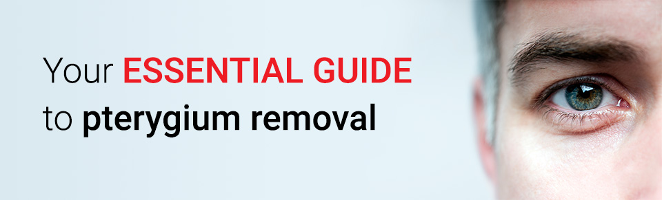 Your essential guide to pterygium removal
